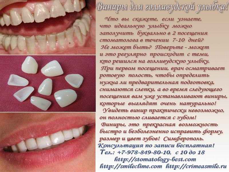 Виниры Для Зубов Цена Астрахань В Аптеке